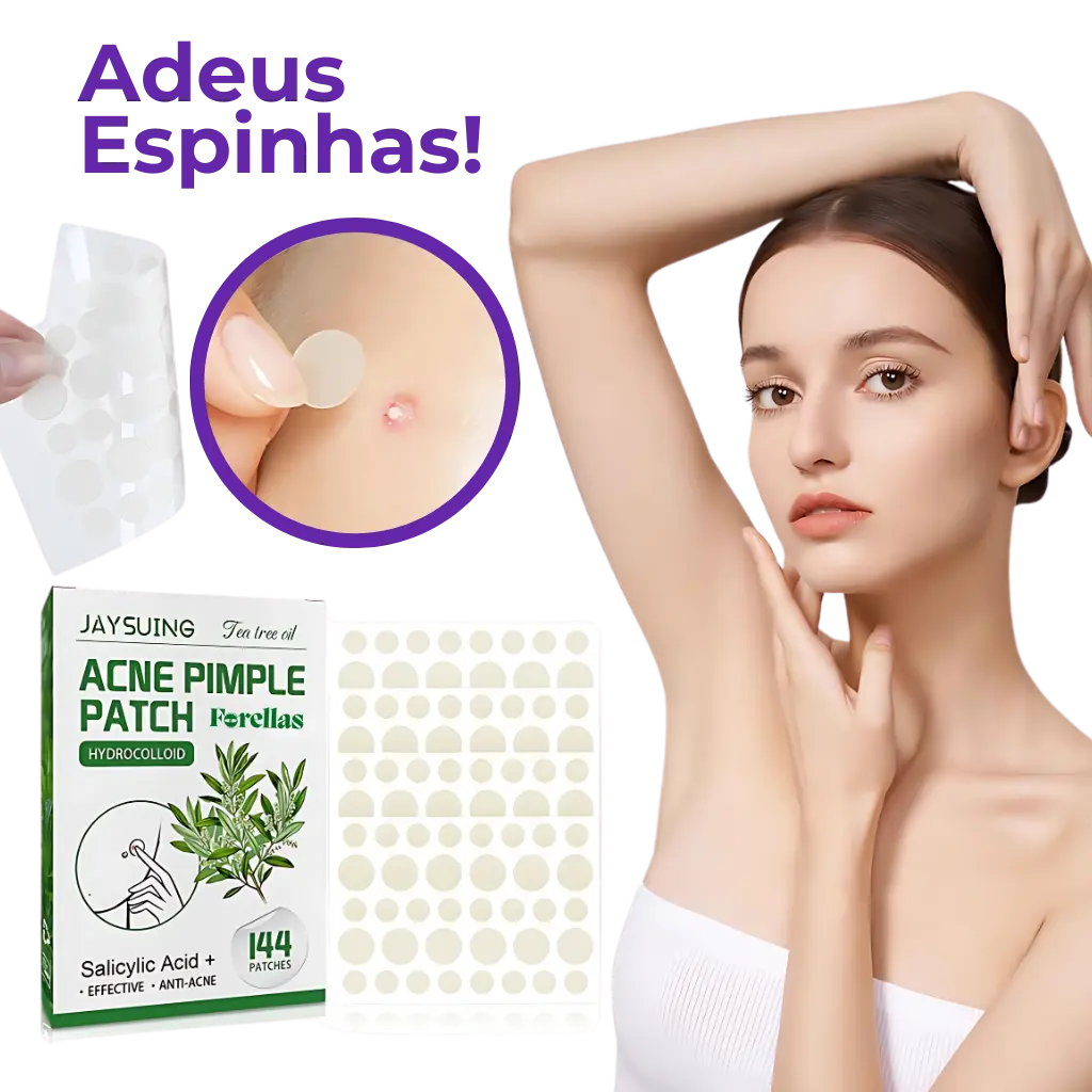 Anti-Acne Patch - Eliminate Pimples without Marks in 1 Day!