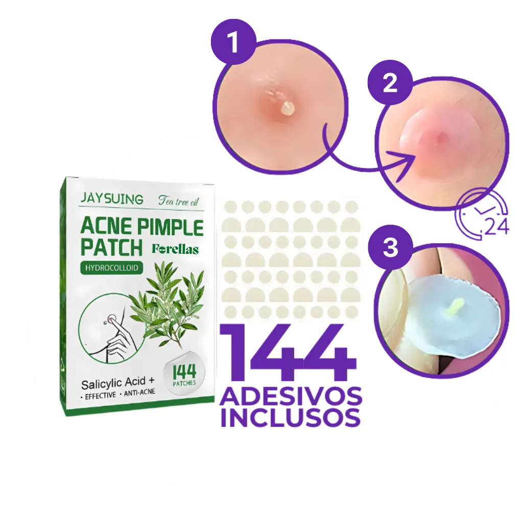 Anti-Acne Patch - Eliminate Pimples without Marks in 1 Day!