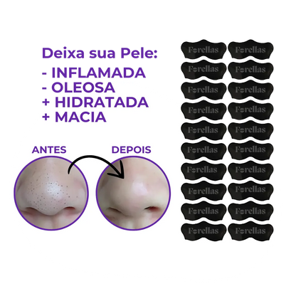 Blackhead Mask - Eliminate Blackheads from Your Nose Painlessly! 