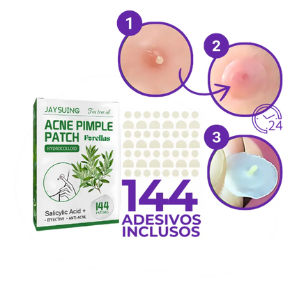 Anti-Acne Patch - Eliminate Pimples without Marks in 1 Day! 